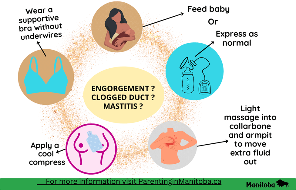 Managing Mastitis