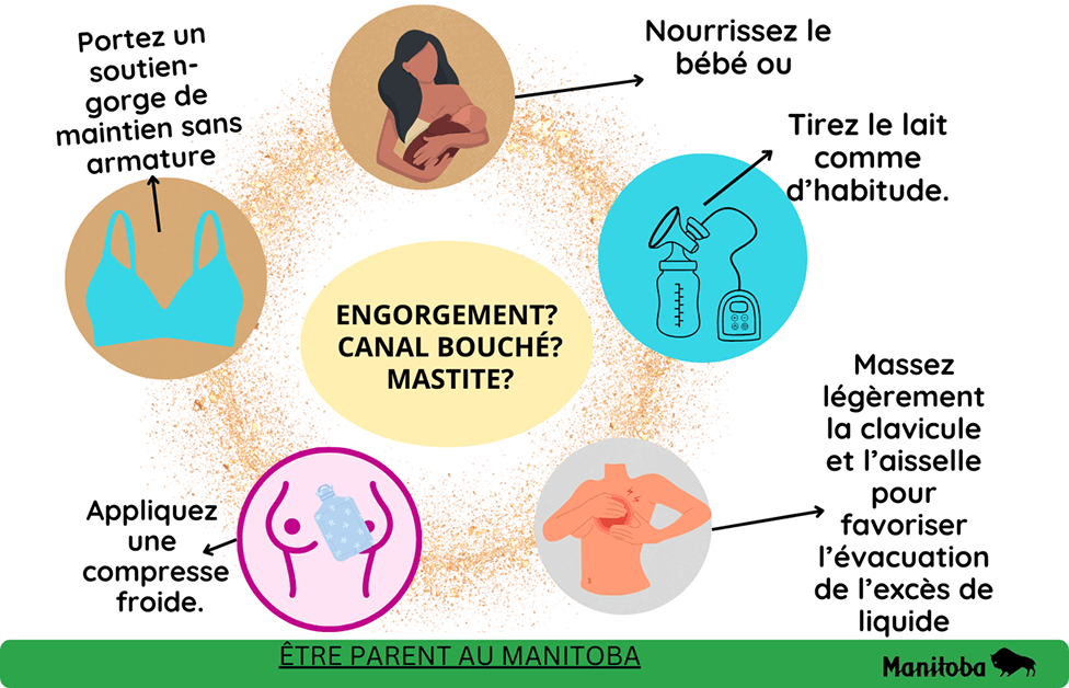 Graphique informatif offrant des conseils aux parents sur la gestion de l’engorgement mammaire, des conduits bloqués ou de la mastite. Il comprend des illustrations de l’allaitement maternel, d’un soutien-gorge de soutien, d’un tire-lait, d’un massage et d’une compresse froide, accompagnées d’instructions texte et du logo du Manitoba.