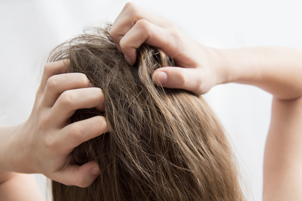 Arrière de la tête d’une personne aux cheveux brun pâle. La personne utilise ses deux mains pour gratter son cuir chevelu, les doigts écartés.
